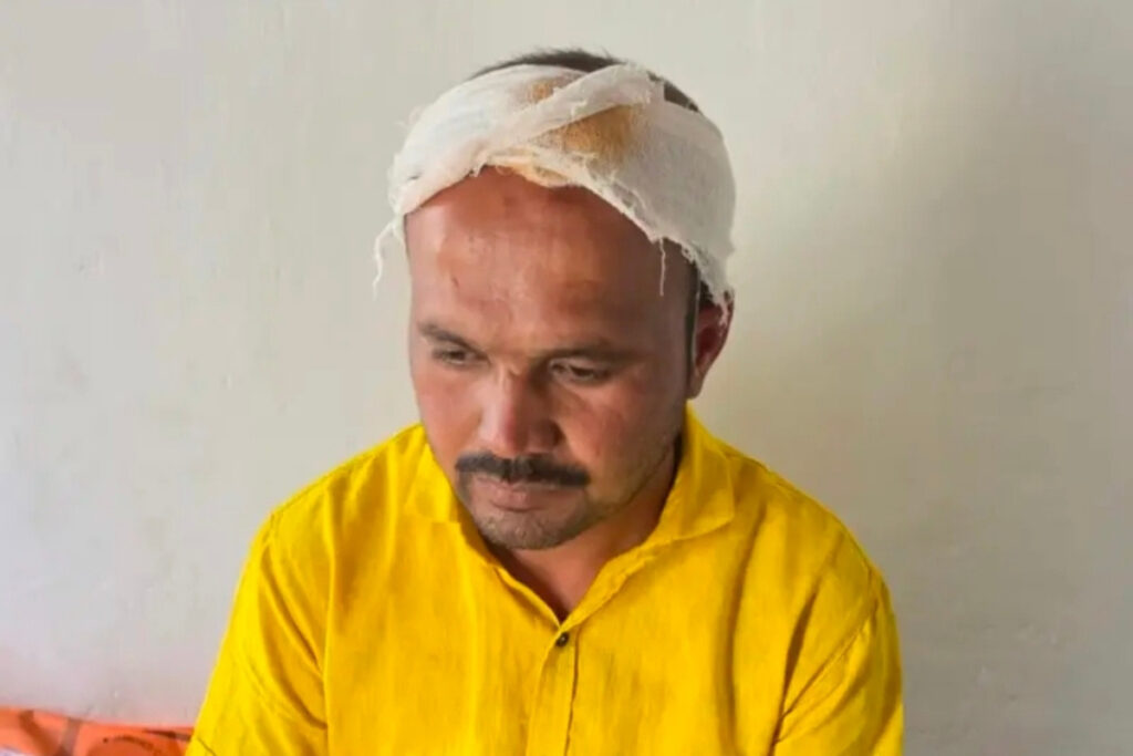 Why wasn't my name announced at the wedding?, Talathi attacks Gram Panchayat member, shocking incident in Jamkhed Taluka, Ashok Pathade, shivaji hajare,