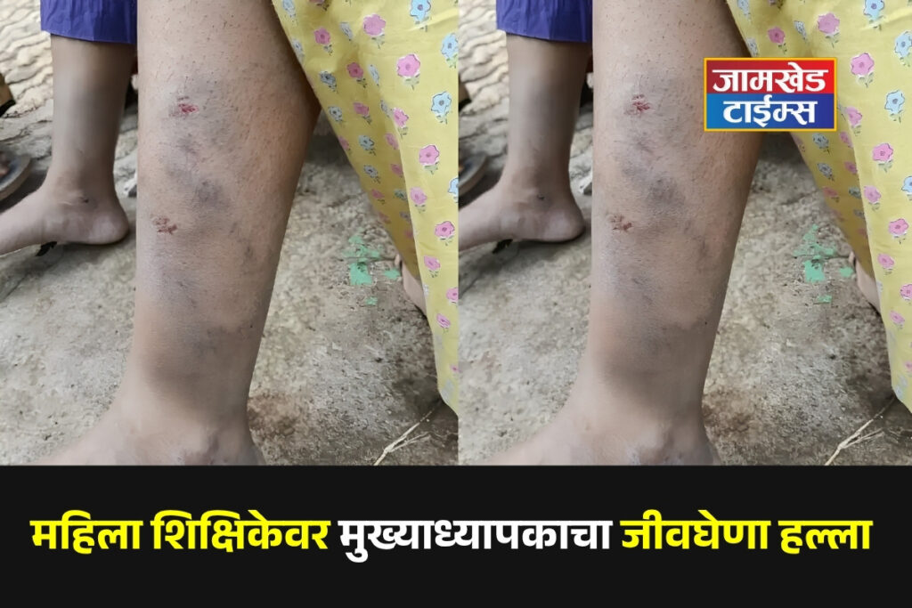 Teacher or Thug? Headmaster Launches Life-Threatening Attack on Female Teacher, Terrifying Ordeal Unfolds on School Grounds, wai, satara, khawali, Dharmendra Vishnu Dixit news