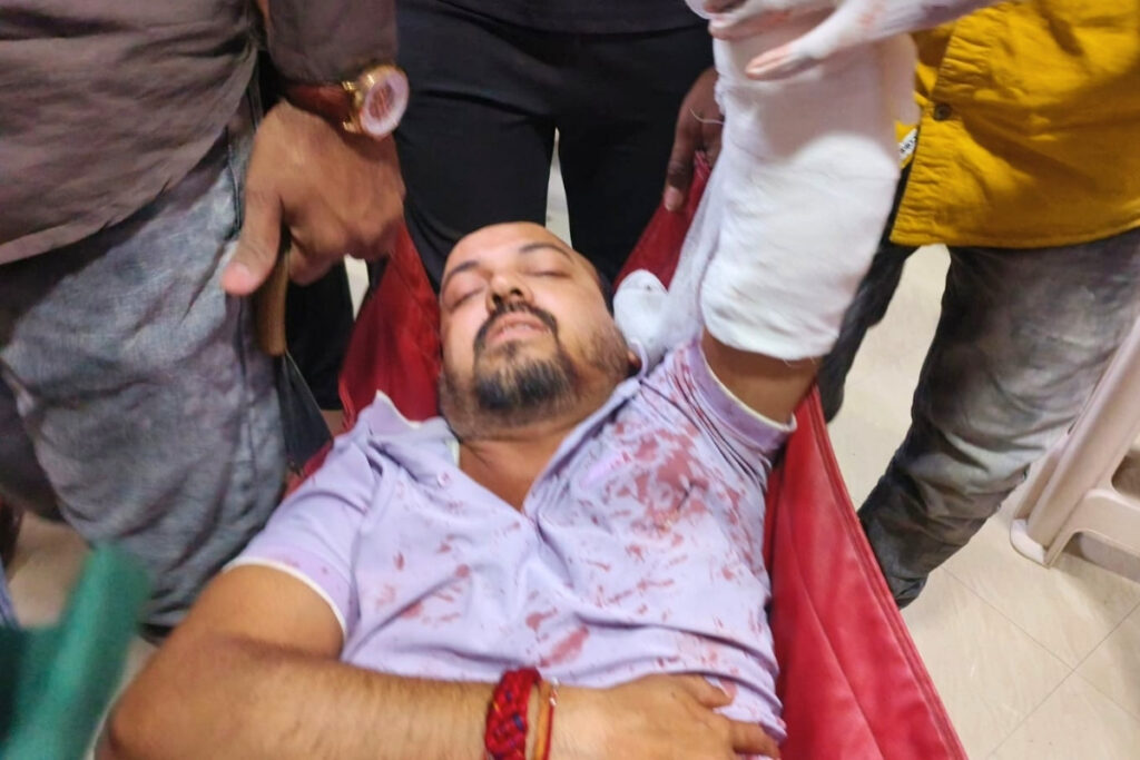 Jamkhed, Deadly attack on Kala Kendra operator Rahul Andhare, case registered against three individuals, Ashti connection revealed,
